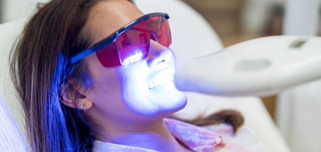 blanqueamiento dental profesional