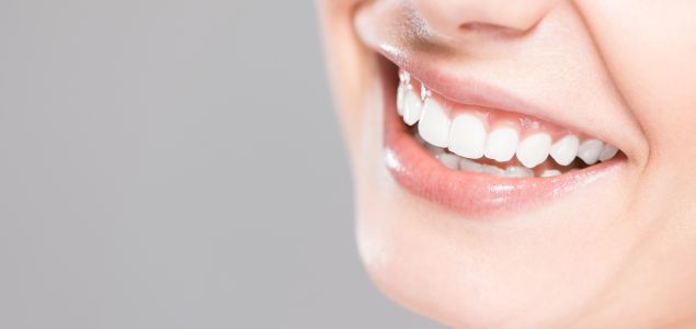 Blanqueamiento dental