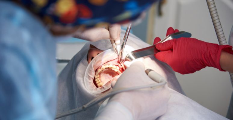 postoperatorio de una cirugía de extracción de dientes