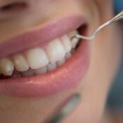 consejos de limpieza para prevenir las caries