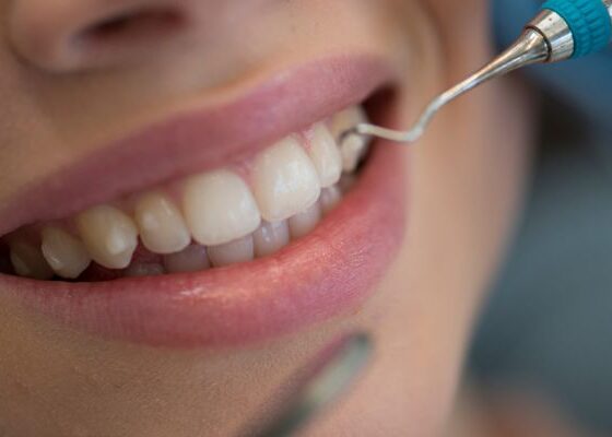 Cómo prevenir las caries: hábitos y alimentos clave