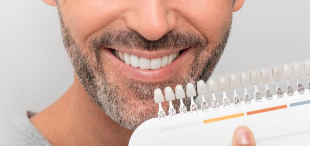 tipos de blanqueamiento dental en clínica