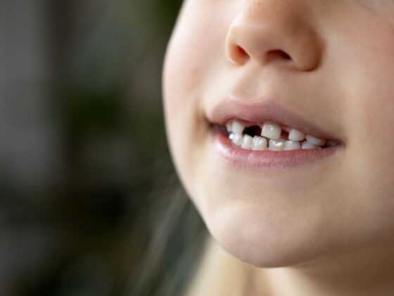 Cuidado de los dientes de leche: lo que todo padre debe saber